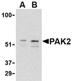 PAK2 Antibody