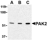 PAK2 Antibody