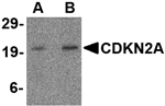 CDKN2A Antibody