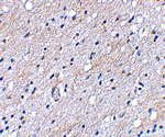 BAP3 Antibody