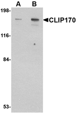 CLIP170 Antibody