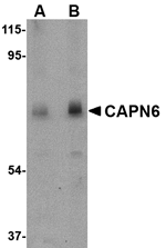 CAPN6 Antibody