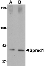 Spred1 Antibody