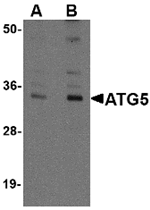 ATG5 Antibody