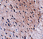 Bora Antibody