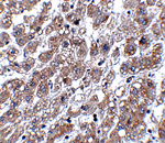 MATN1 Antibody