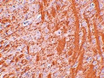 JMJD6 Antibody