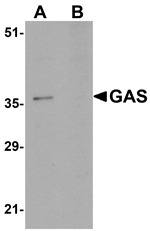 GAS Antibody