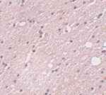 FRMPD4 Antibody