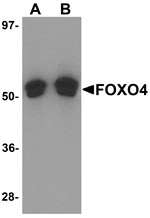 FOXO4 Antibody