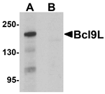 Bcl9L Antibody