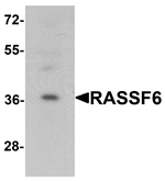 RASSF6 Antibody