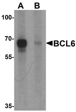 BCL6 Antibody