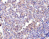 MD-2 Monoclonal Antibody