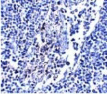 IL-33 Monoclonal Antibody