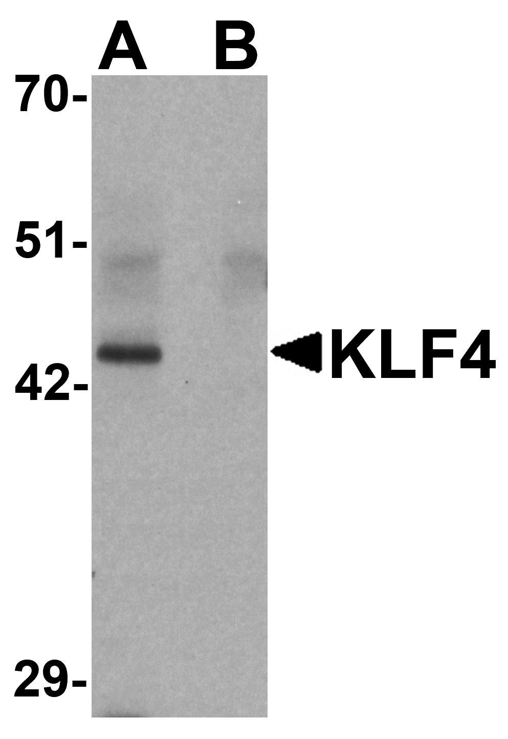 KLF4 Monoclonal Antibody