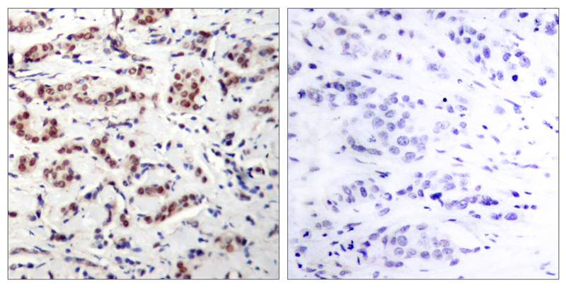 STAT5a(Phospho-Tyr694) Antibody