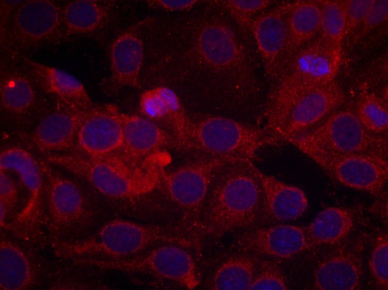 VEGFR2(Phospho-Tyr1175) Antibody