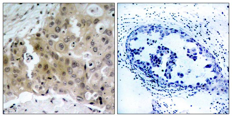 VEGFR2(Phospho-Tyr1175) Antibody