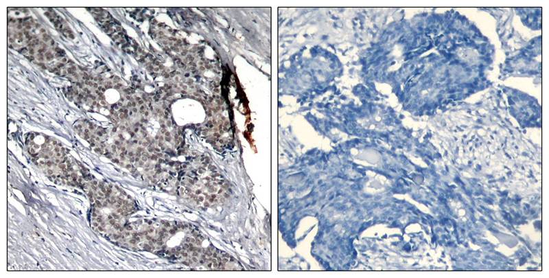 p53(Phospho-Ser6) Antibody