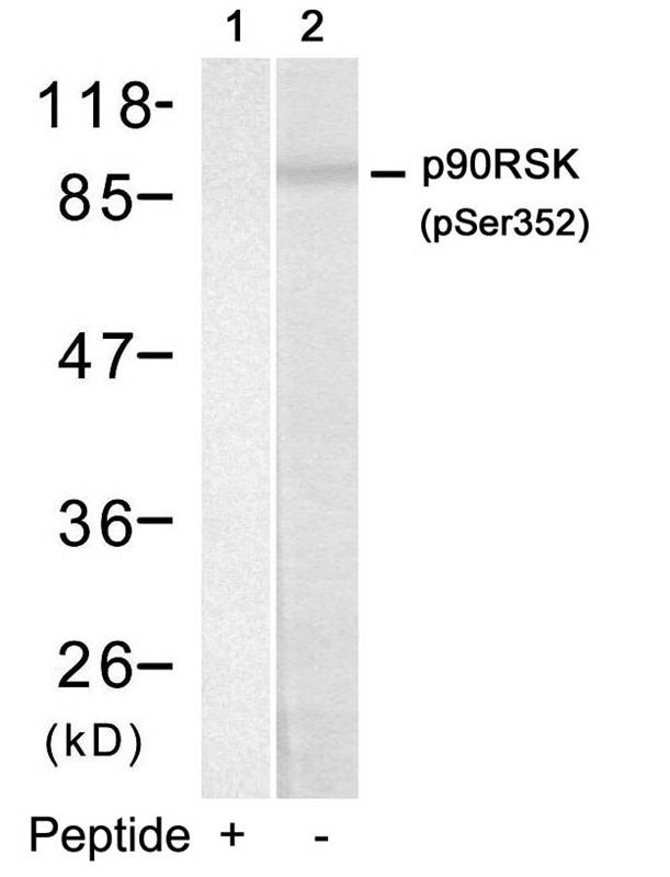 p90RSK(Phospho-Ser352) Antibody