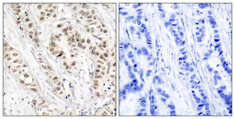 BRCA1(Phospho-Ser1524) Antibody