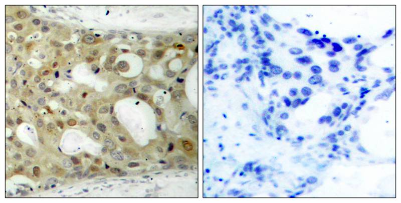 Androgen Receptor(Phospho-Ser650) Antibody