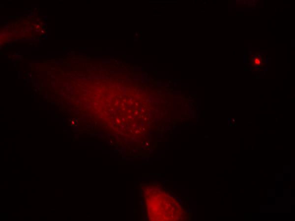 FKHR(Phospho-Ser319) Antibody