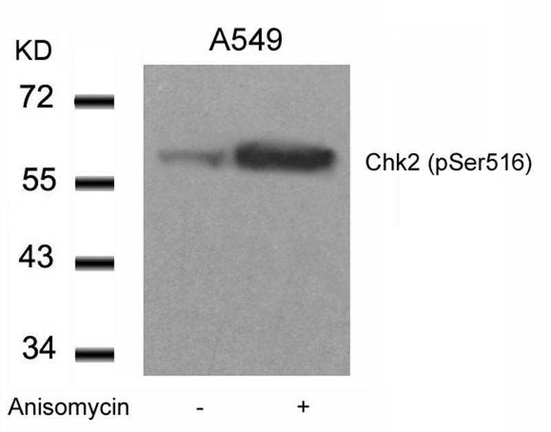 Chk2(Phospho-Ser516) Antibody