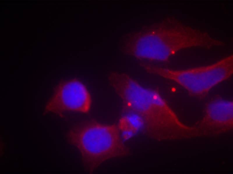 NMDAR2B(phospho-Tyr1474) Antibody