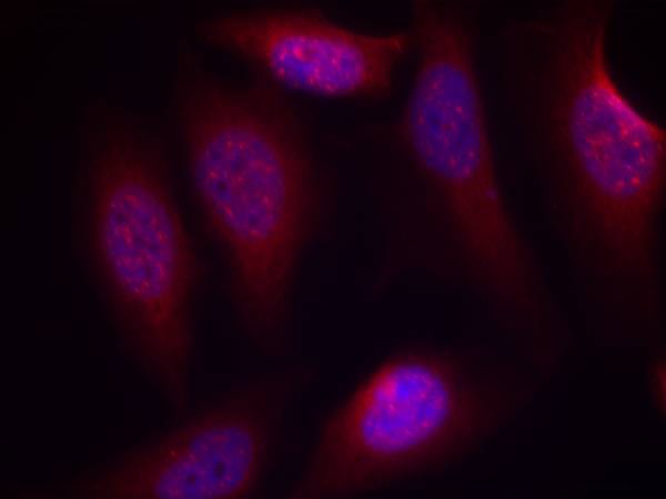 SEK1/MKK4(Phospho-Ser80) Antibody