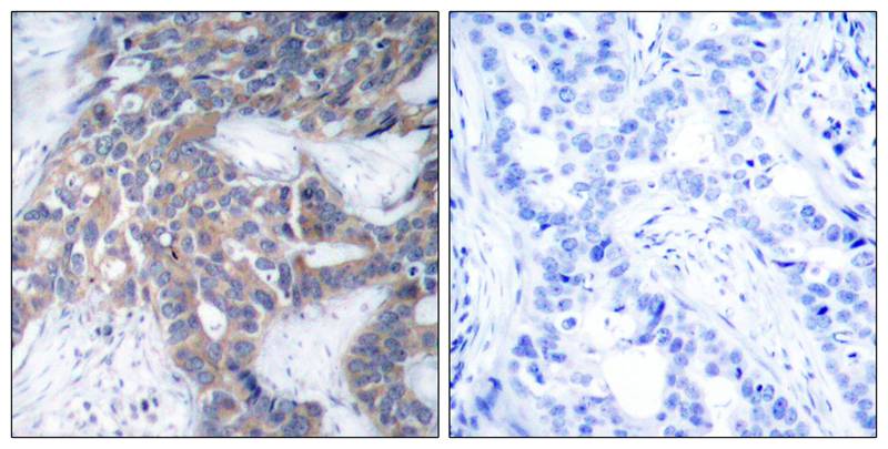 MEK1/MEK2(Phospho-Ser217/Ser221) Antibody