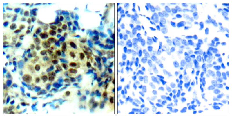 p44/42 MAP Kinase(Phospho-Thr202) Antibody