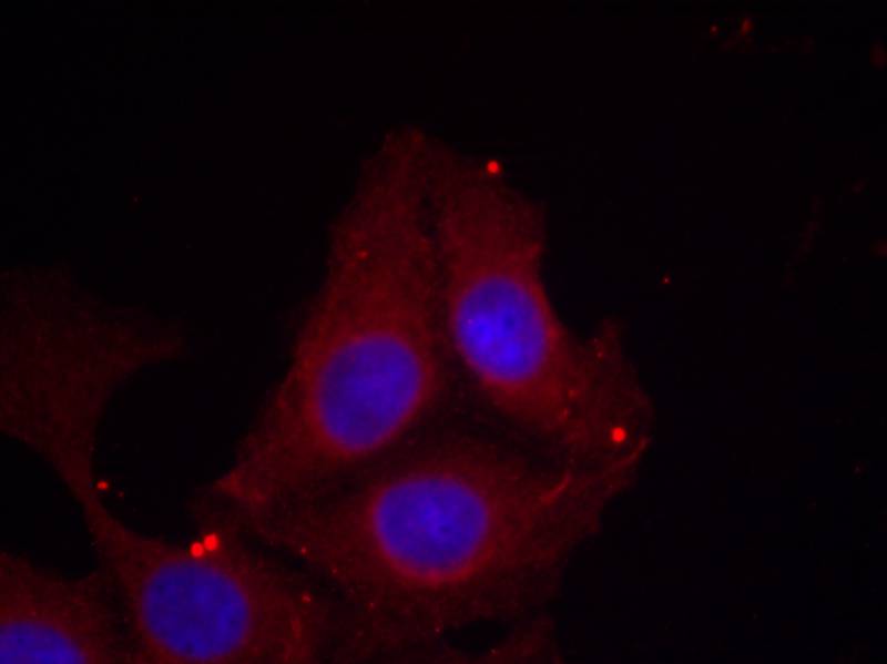 GAP43(Phospho-Ser41) Antibody