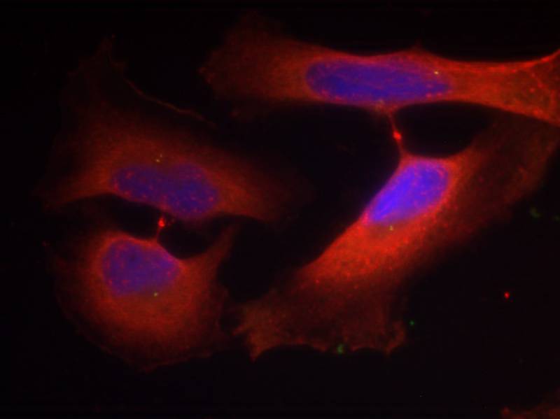 Keratin 8(Phospho-Ser74) Antibody