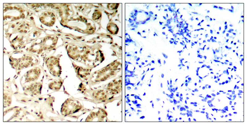 MEF2a(Phospho-Ser408) Antibody