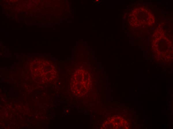 Myc(Phospho-Ser62) Antibody