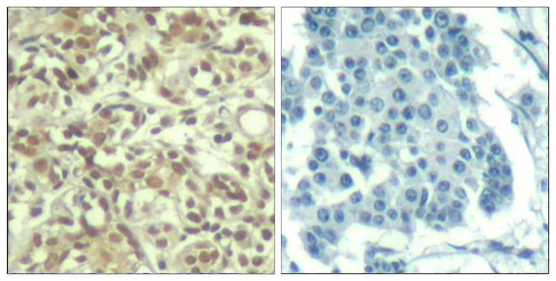 AKT1(phospho-Thr450) Antibody