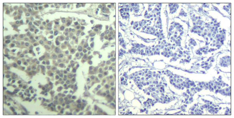 c-kit(phospho-Tyr936) Antibody