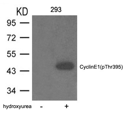 Cyclin E1(phospho-Thr395) Antibody