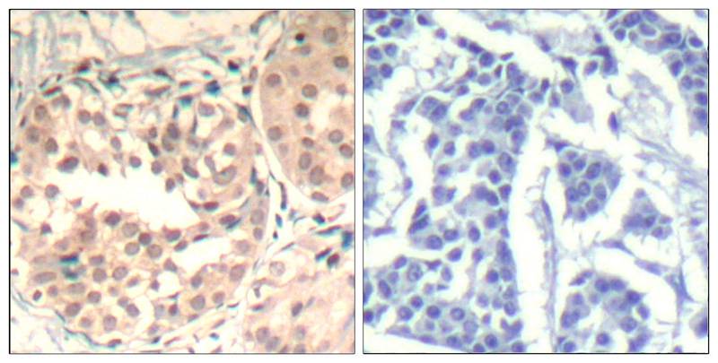 CDK6(phospho-Tyr13) Antibody