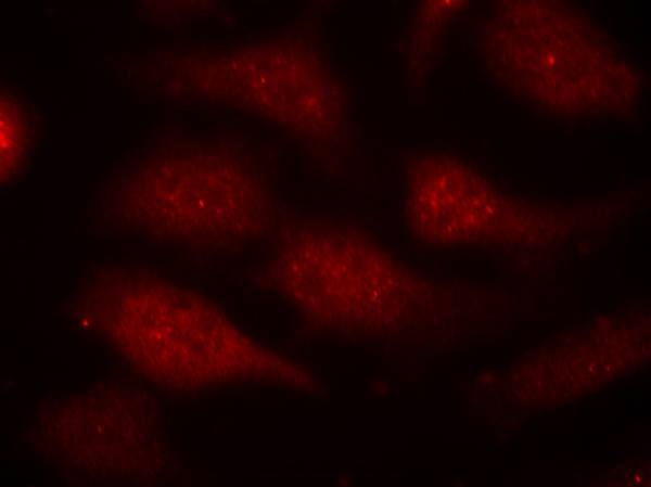 CDK6(phospho-Tyr24) Antibody