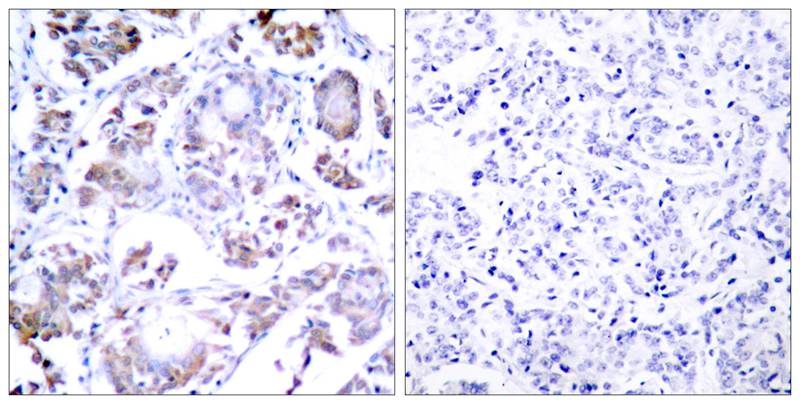 NFkB-p65(Ab-254) Antibody