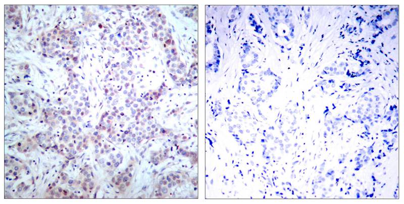 NFkB-p65(Ab-536) Antibody