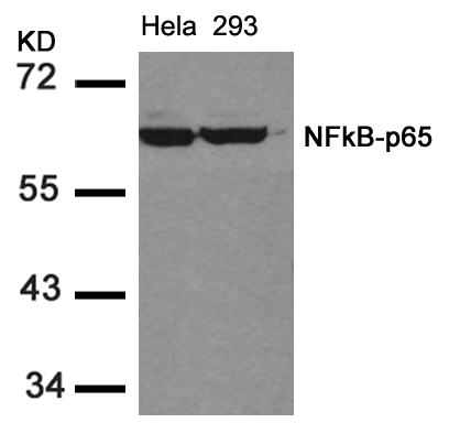 NFkB-p65(Ab-536) Antibody