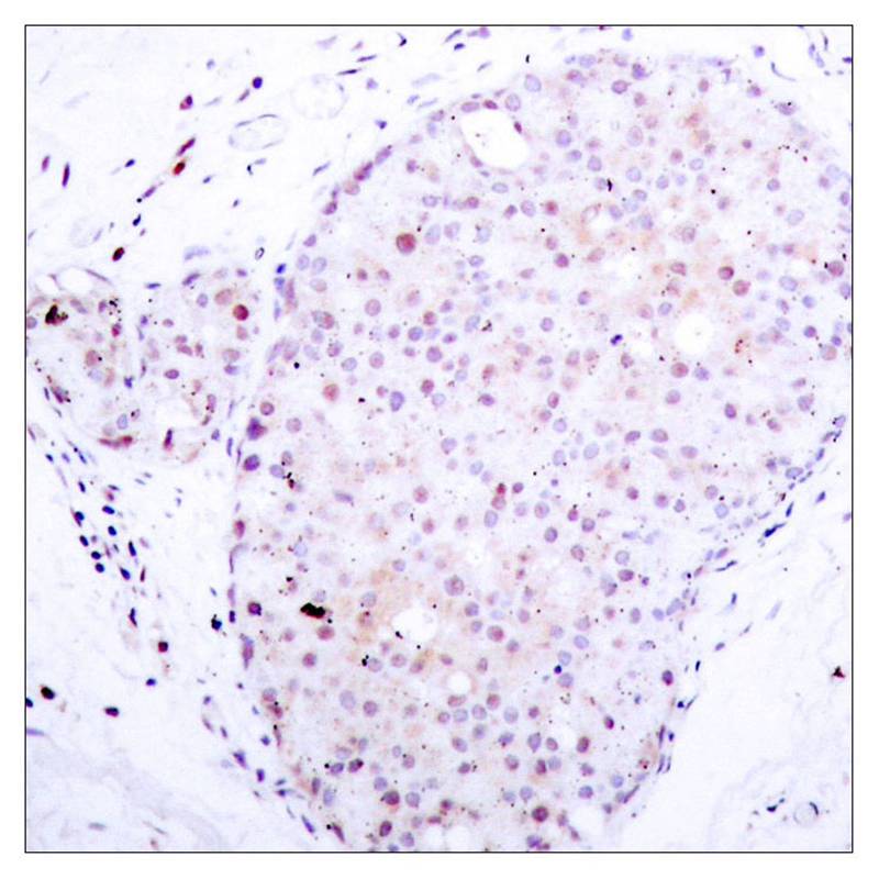 NFkB-p105(Ab-907) Antibody