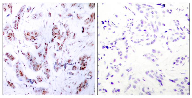 MEF2a(Ab-312) Antibody