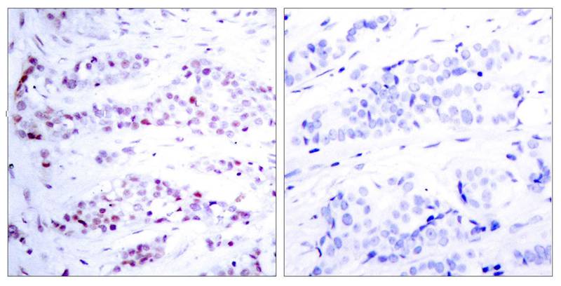 STAT6(Ab-641) Antibody