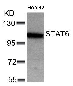 STAT6(Ab-641) Antibody