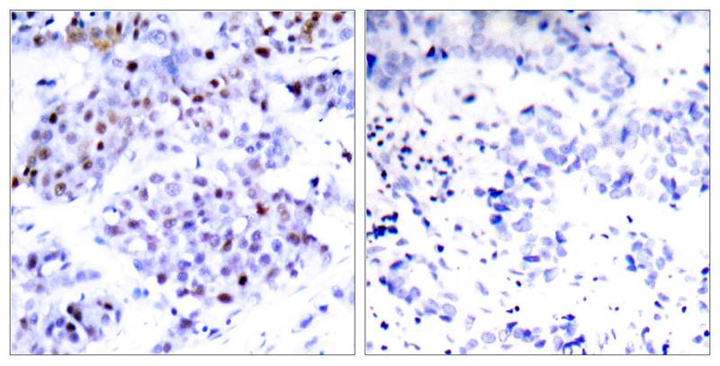 STAT6(Ab-645) Antibody